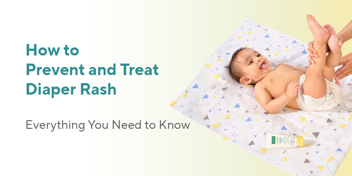How to Prevent and Treat Diaper Rash: Everything You Need to Know
