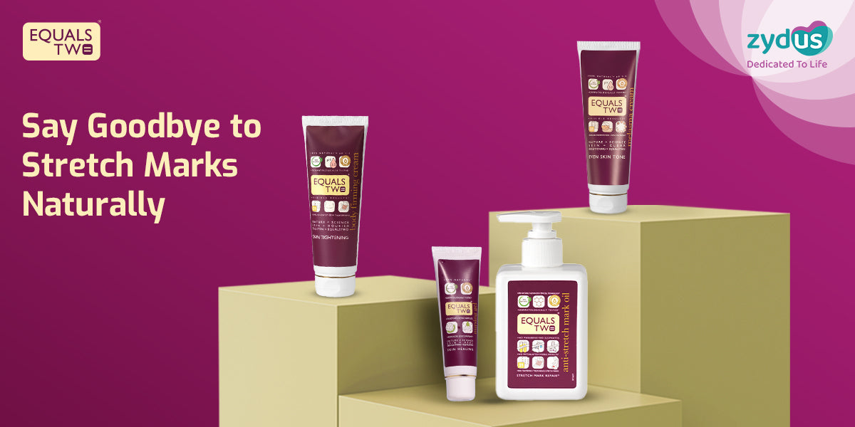 Say Goodbye to Stretch Marks Naturally