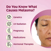 EQUALSTWO  Melasma Cream