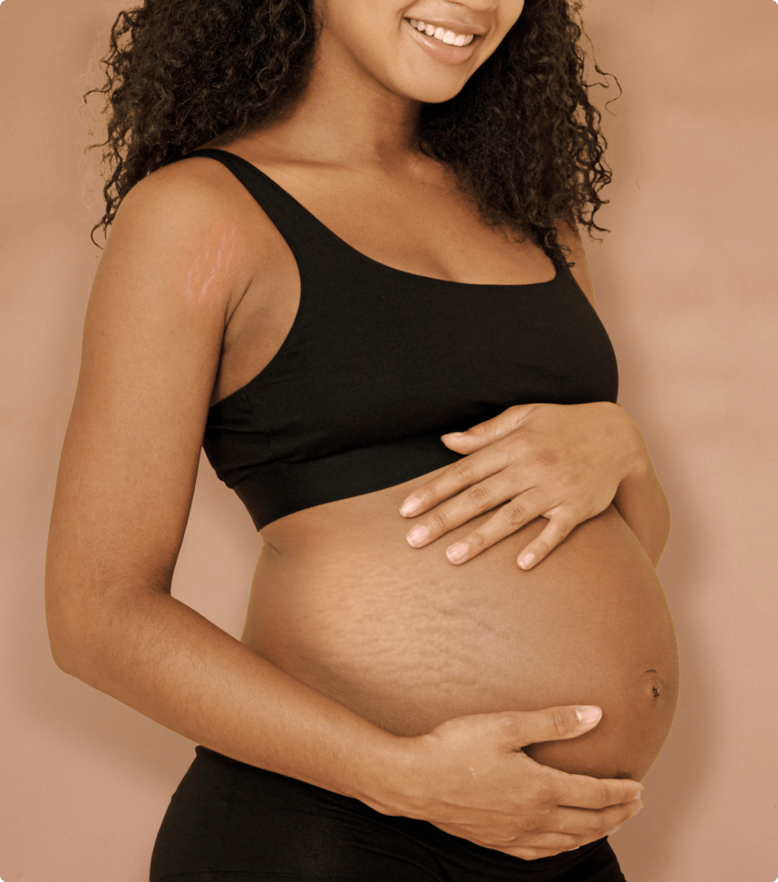 Stretch mark removal cream